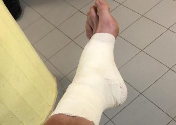 Así quedó el tobillo de juan