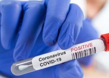 1 muerto en jesùs marìa y otro en colonia caroya por covid