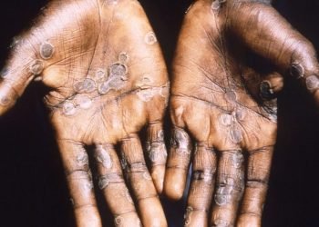 628d6eeb92dd1 1200 1140x641