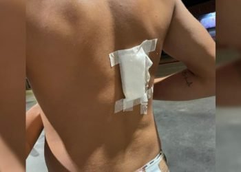 Adolescente apuñalado